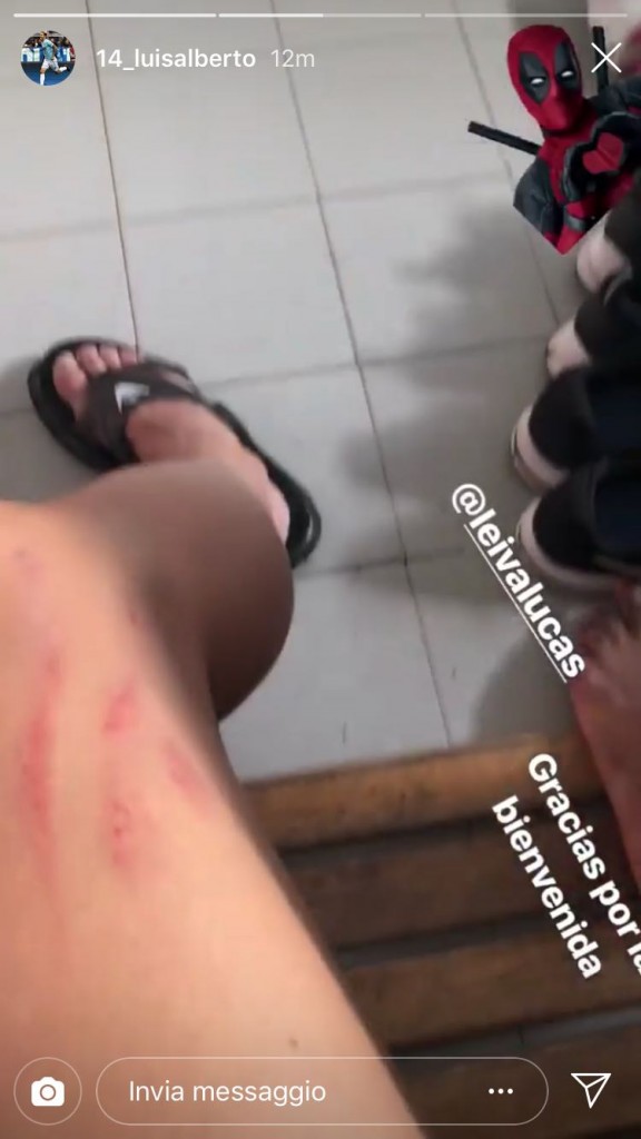 luis alberto instagram