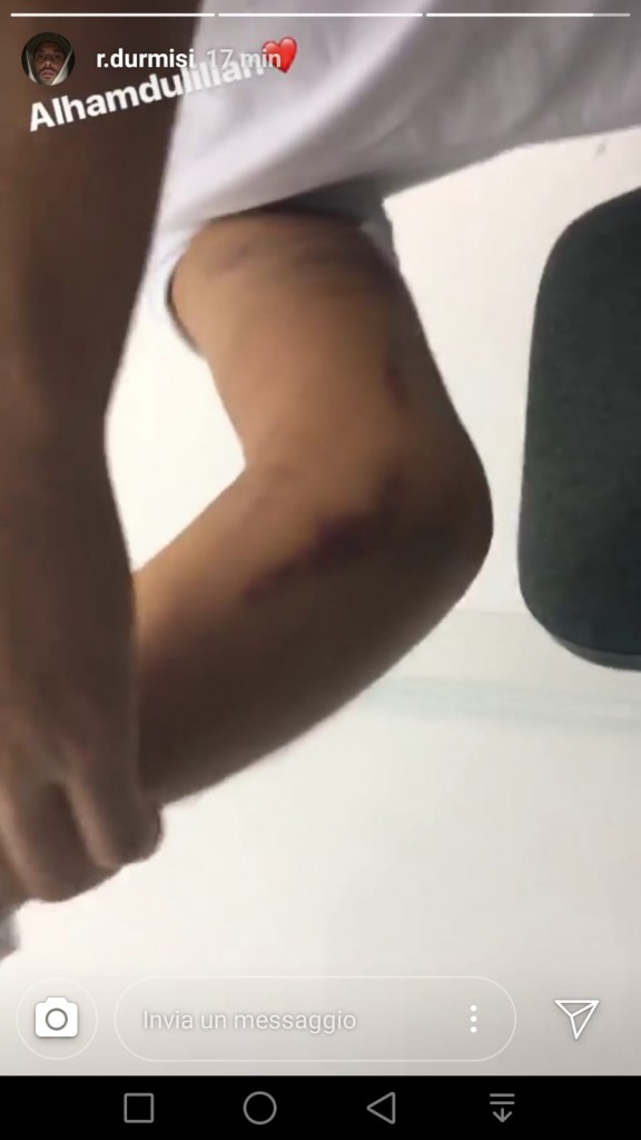 Riza Durmisi mostra il suo gomito infortunato su Instagram.